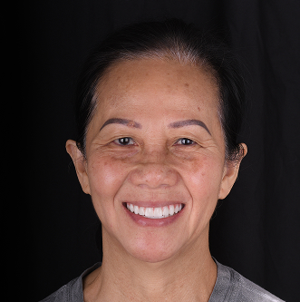 Patinet Transformation Image