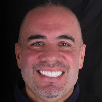 Patinet Transformation Image