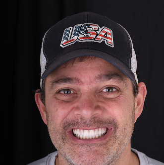 Patinet Transformation Image