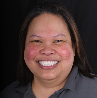 Patinet Transformation Image