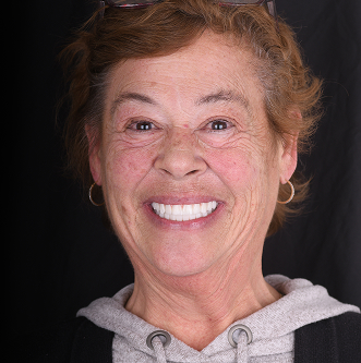 Patinet Transformation Image