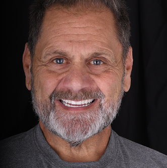 Patinet Transformation Image